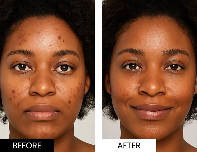 Glokore LED Mask Customer 2