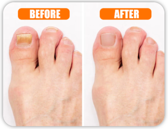 Hewelth BioClear Nails Benefits