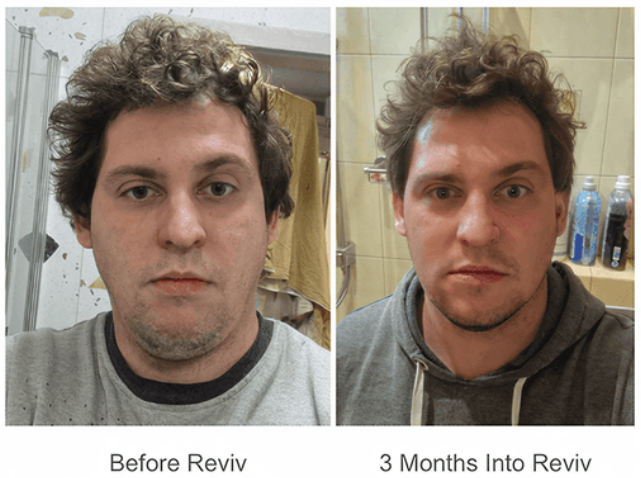 Reviv Mouth Guard Customer Reviews